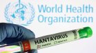 Д-р Аспарух Илиев: Хантавирусът няма да предизвика нова пандемия