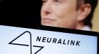 Neuralink имплантира мозъчен чип в трети човек