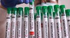 Проф. Радка Аргирова: Хантавирусът не е нечуван, нито място за страх