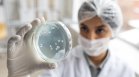 Тиквени семки заразиха със салмонела 81 души във Франция