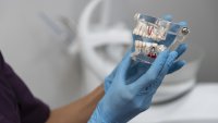 Съвременни зъбни импланти: Какво да очаквате преди, по време и след поставянето?