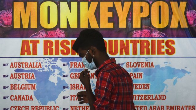 Франция регистрира над 1700 потвърдени случая на маймунска шарка съобщи